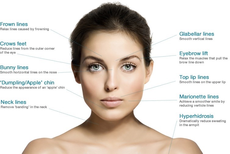 anti-wrinkle-areas